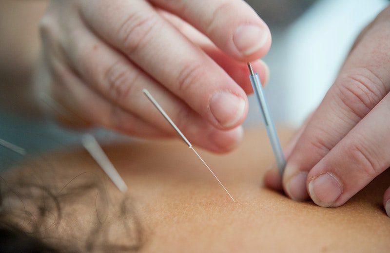 trigger point therapy boulder CO